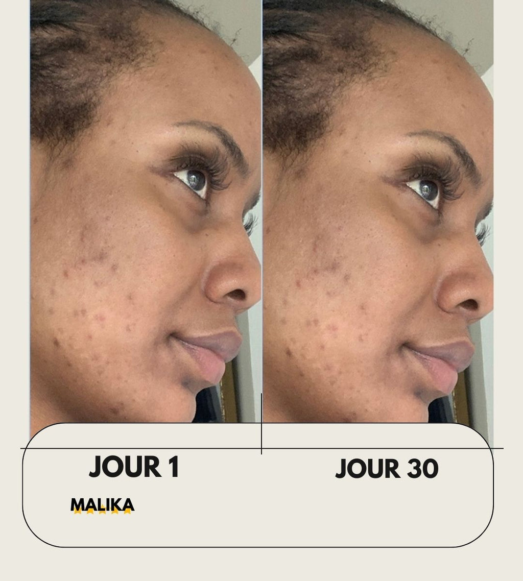 Masque au  curcuma + 1 pinceau applicateur OFFERT